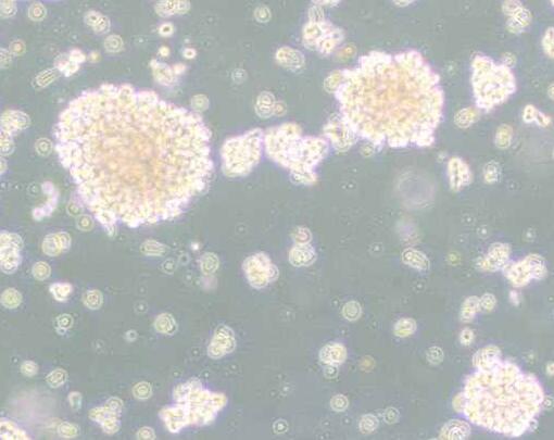 NK-92MI（人恶性非霍奇金淋巴瘤患者的自然杀伤细胞）