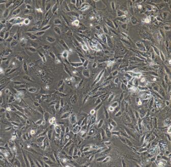 HSPC-1（人造血干细胞）