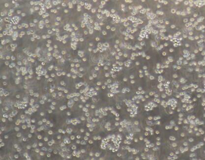 DT40（鸡淋巴瘤细胞）