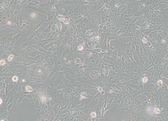 LX-2（人肝星形细胞）