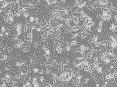 NIT-1（小鼠胰岛素瘤β细胞）