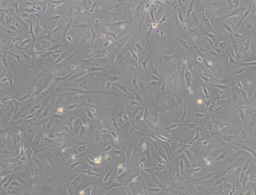 HULEC-5a（人肺微血管内皮细胞）