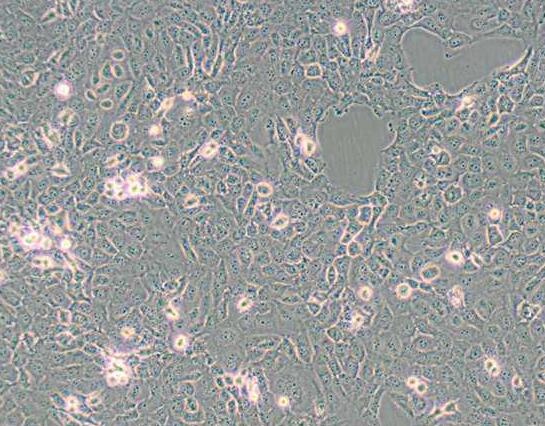 B-CPAP(人甲状腺乳头状癌细胞)