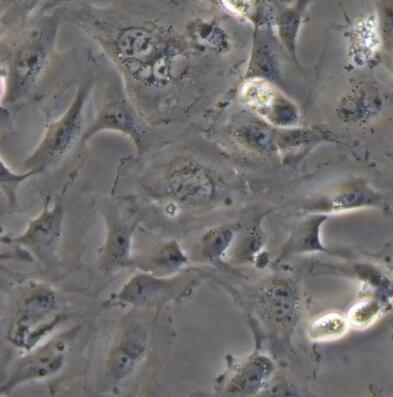 HMEC-1(人微血管内皮细胞)