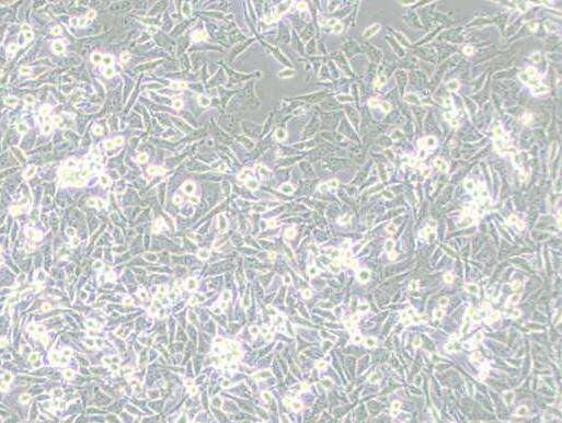 PATU8988T(人胰腺癌细胞)