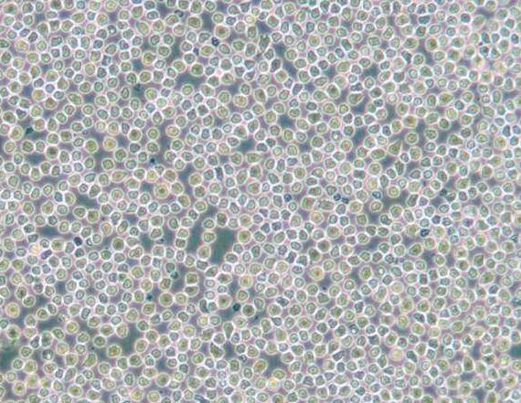 HAL-01（人淋巴细胞白血病细胞）