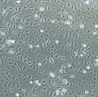 HTR-8/Svneo（人绒毛膜滋养层细胞）