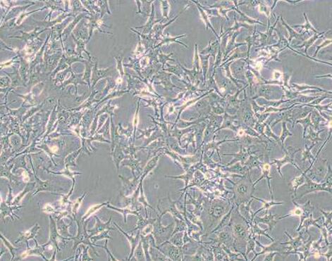 B16-F0（小鼠黑色素瘤细胞）