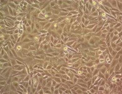 HIT-T15（仓鼠胰岛β细胞）