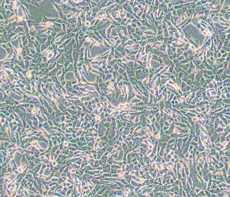 SUM159PT（人乳腺癌细胞系）