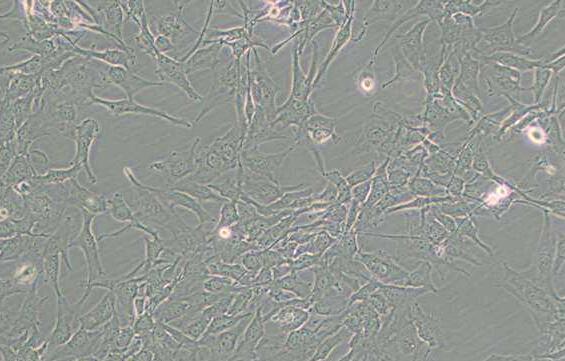 KHM-5M（人甲状腺癌细胞(未分化)）