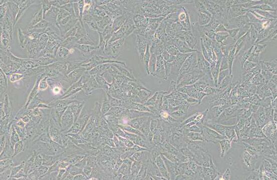 TCCSUP（人膀胱癌细胞）