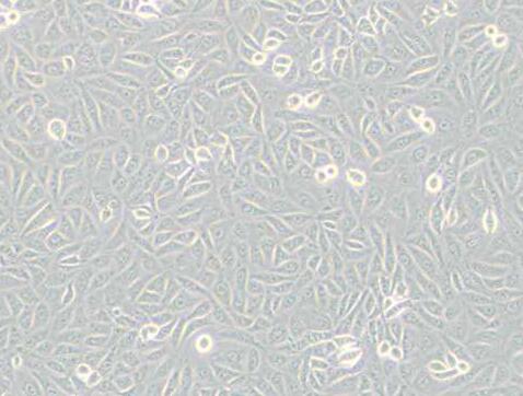 TPC-1（人甲状腺癌细胞）