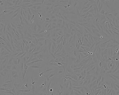 FTC-133(人滤泡状甲状腺癌细胞)