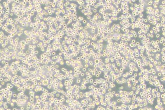 DB（弥漫大B细胞淋巴瘤细胞）