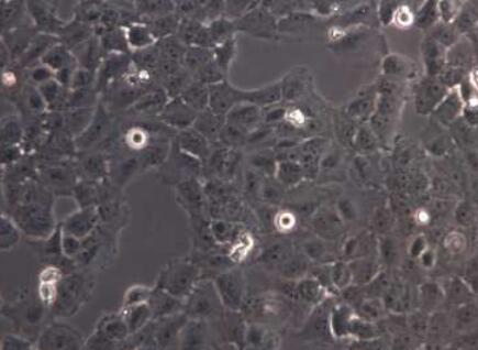 鸡肺动脉内皮细胞