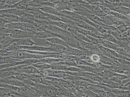 人脐带间充质干细胞