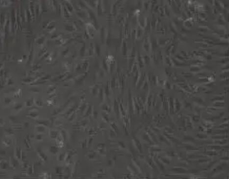 人肺大静脉内皮细胞