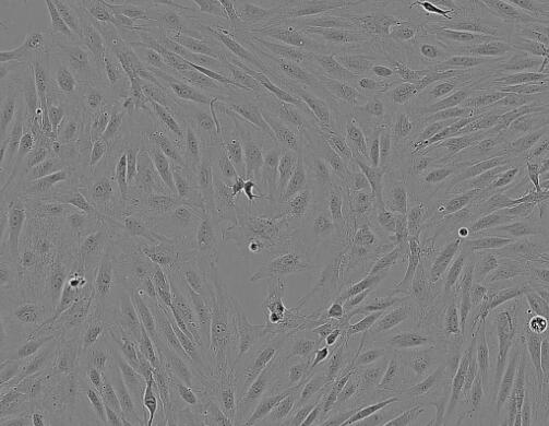 人肺大静脉平滑肌细胞