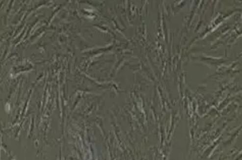 人气管平滑肌细胞