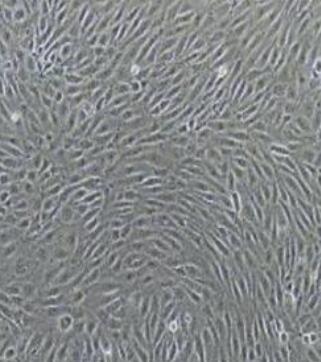 人淋巴管内皮细胞