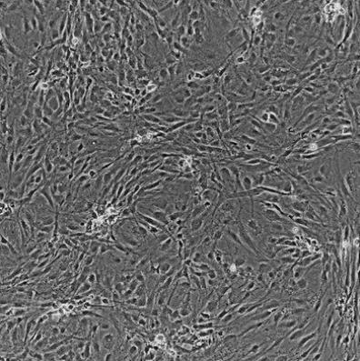 人肠动脉内皮细胞