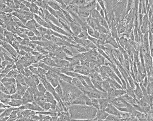 人卵巢成纤维细胞
