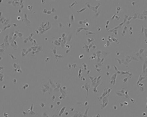人子宫内膜上皮细胞