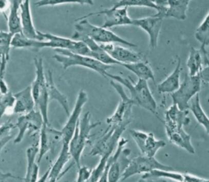 人膀胱移行上皮细胞