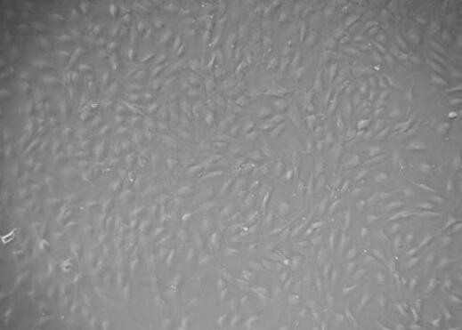 人肾动脉内皮细胞