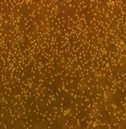 人膀胱成纤维细胞