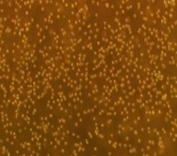 人心肌成纤维细胞