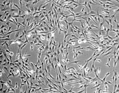 人心脏微血管内皮细胞