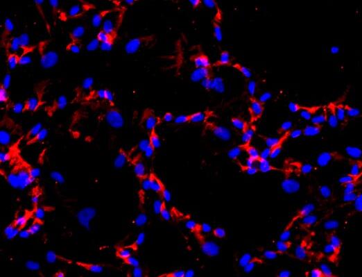 人脐静脉平滑肌细胞