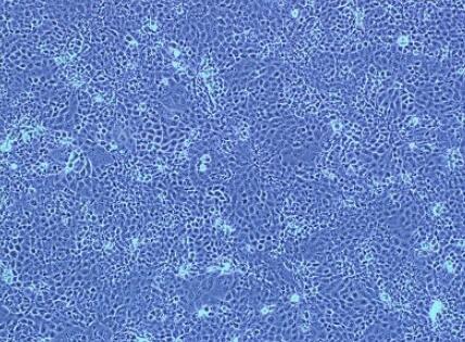 人脐动脉平滑肌细胞