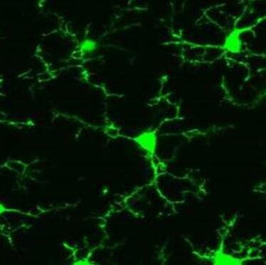 人神经小胶质细胞