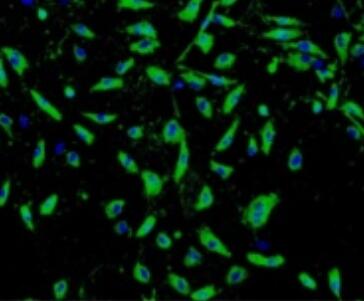 人角膜内皮细胞