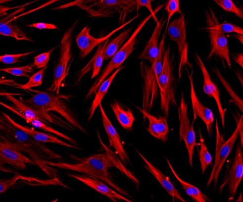 人牙周膜成纤维细胞