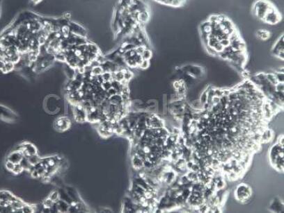 人食管癌组织源细胞