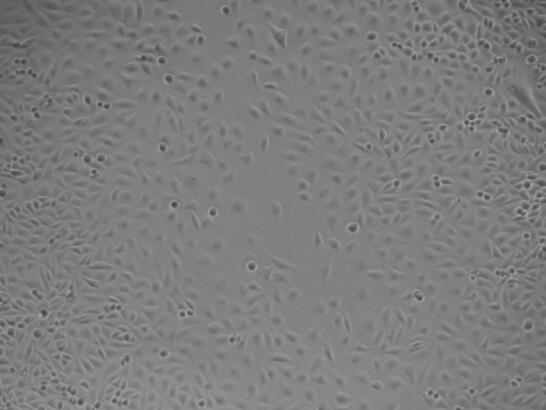 人胃癌组织源细胞