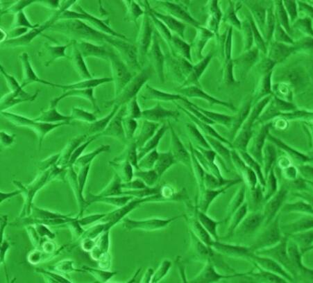 人卵巢癌组织源细胞