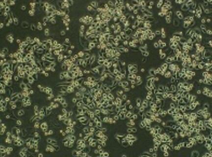 人甲状腺癌组织源细胞