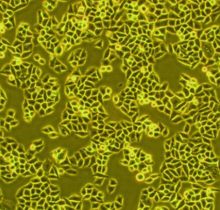 人宫颈癌组织源细胞