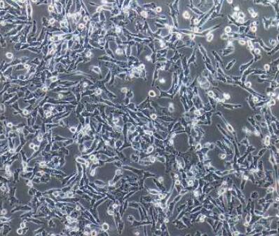 人前列腺癌组织源细胞