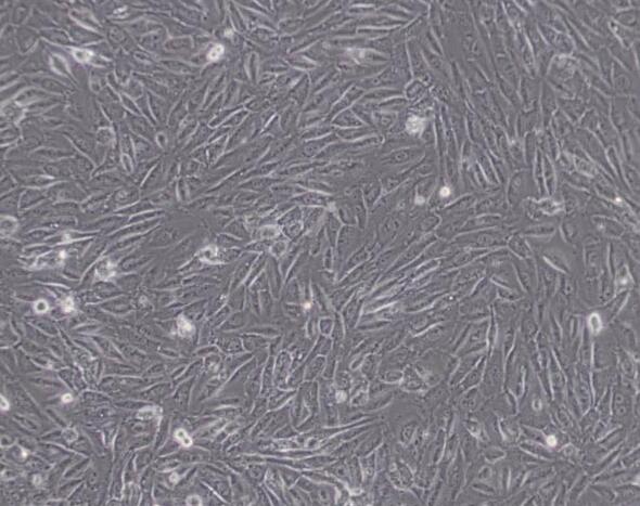 人脐静脉血来源内皮祖细胞