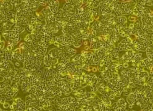 人冠状动脉平滑肌细胞