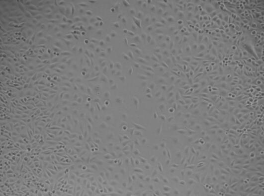 人退行性椎间盘髓核细胞