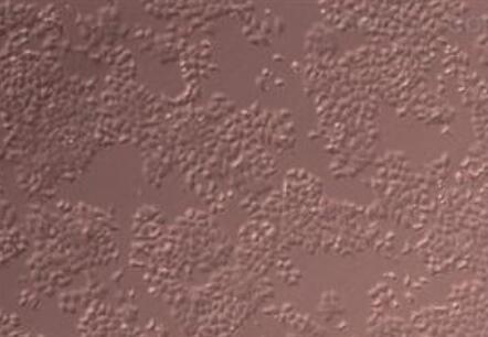 人腹膜间皮细胞