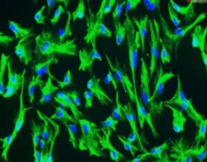 人骨髓来源巨噬细胞