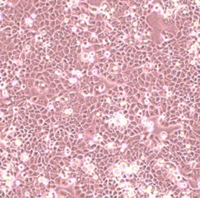 人子宫内膜基质细胞